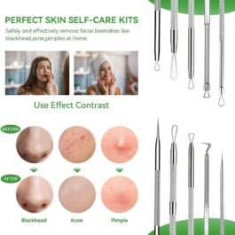 Blackhead Remover Tool,4 Pcs